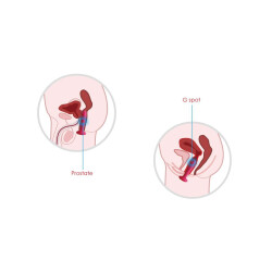 SVAKOM Anal-Plug mit Vibration, W&auml;rmefunktion &amp; Fernbedienung Schwarz