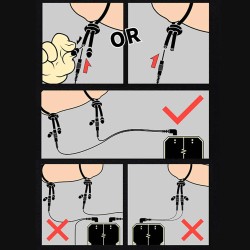 DUNGEON LAB Conductive Rubber Rings Pro Ø 6 mm 2 St.