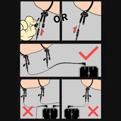 DUNGEON LAB Conductive Mesh Rings Ø 4 mm 2 St.