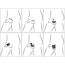 YOU 2 TOYS Penis- & Hodenring-Set 6-teilig Schwarz